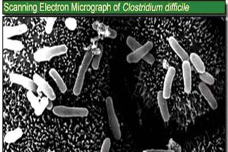 microscopic scan of c diff